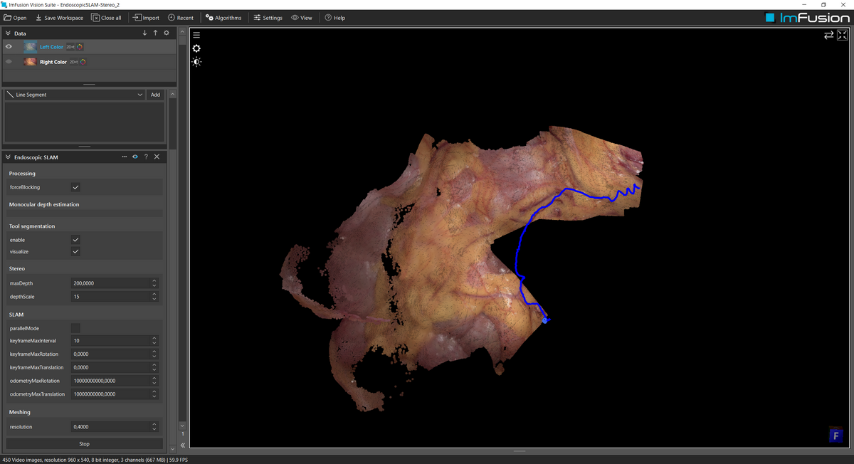 Zivid Industrial 3d Camera Computer Vision Suite Perpetual – ImFusion