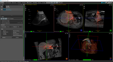 Load image into Gallery viewer, ImFusion 3D Ultrasound Suite - perpetual license
