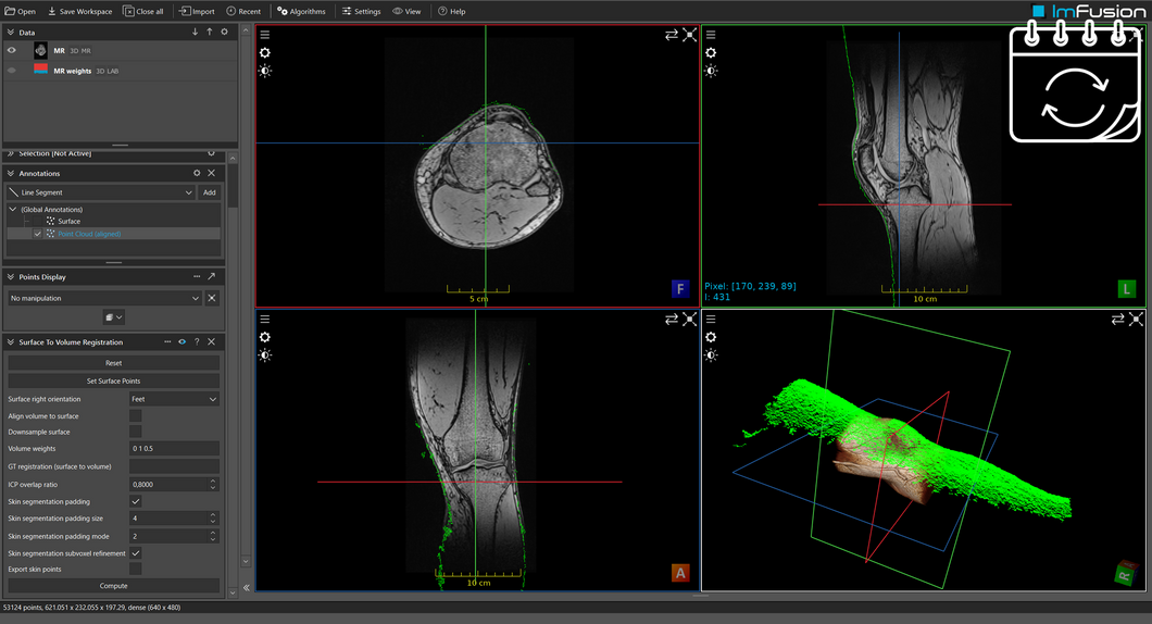 ImFusion Computer Vision Suite - annual subscription