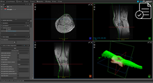 Load image into Gallery viewer, ImFusion Computer Vision Suite - perpetual license
