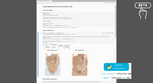 ImFusion Python SDK - beta release