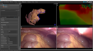 ImFusion Computer Vision Suite - annual subscription