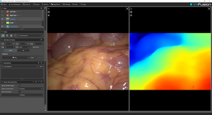 ImFusion Computer Vision Suite - annual subscription