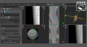 ImFusion X-ray & CT Suite - annual subscription