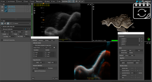 ImFusion 3D Ultrasound Suite - annual subscription