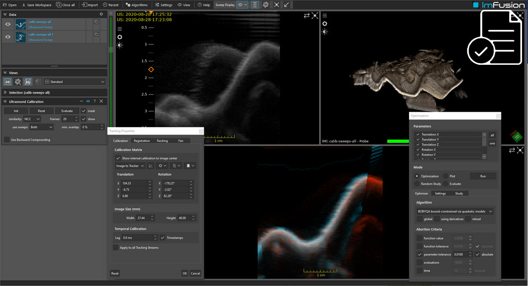 ImFusion 3D Ultrasound Suite - perpetual license